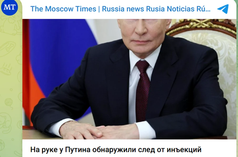 Suspicious spot on Putin’s hand. New speculations about his health status. What doctors consulted by Moscow Times say